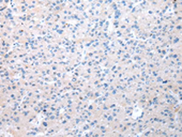 Rabbit Polyclonal Antibody to WDR19