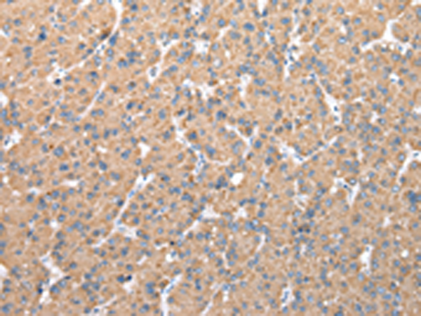Rabbit Polyclonal Antibody to CFAP52