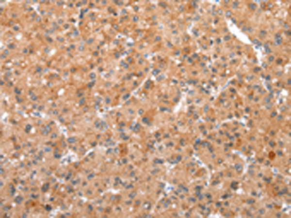 Rabbit Polyclonal Antibody to WDR61