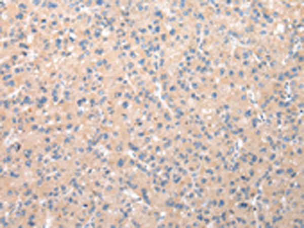 Rabbit Polyclonal Antibody to DCAF7