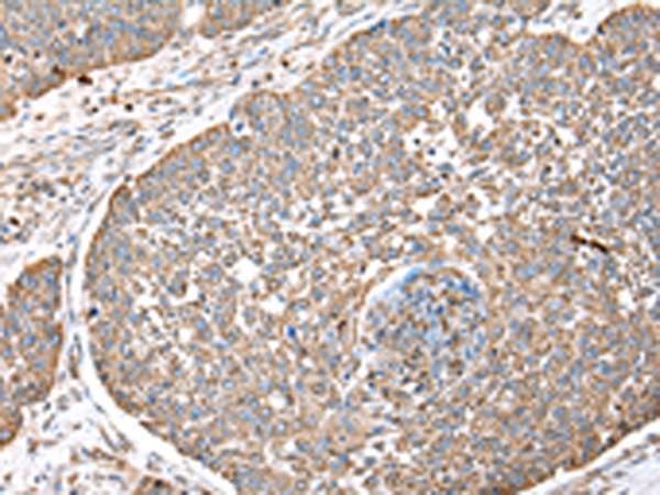 Rabbit Polyclonal Antibody to DPH7