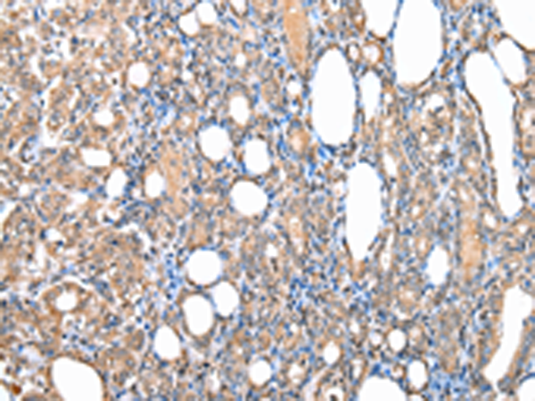 Rabbit Polyclonal Antibody to WRAP53