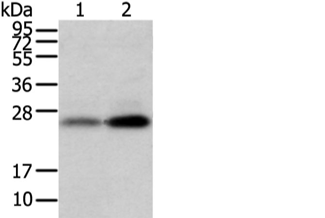 Rabbit Polyclonal Antibody to WFDC5
