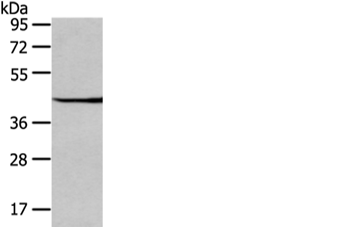 Rabbit Polyclonal Antibody to WIF1