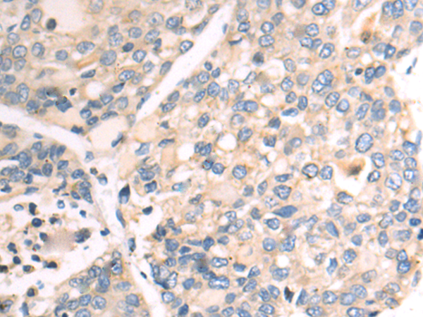 Rabbit Polyclonal Antibody to CCN6