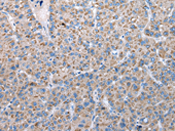 Rabbit Polyclonal Antibody to FKBPL