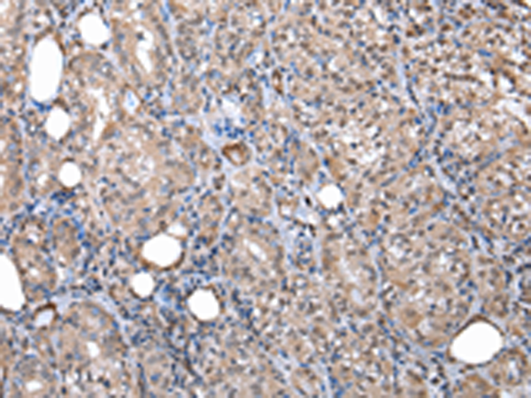 Rabbit Polyclonal Antibody to WSB1