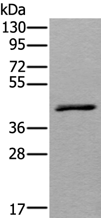 Rabbit Polyclonal Antibody to WSB2