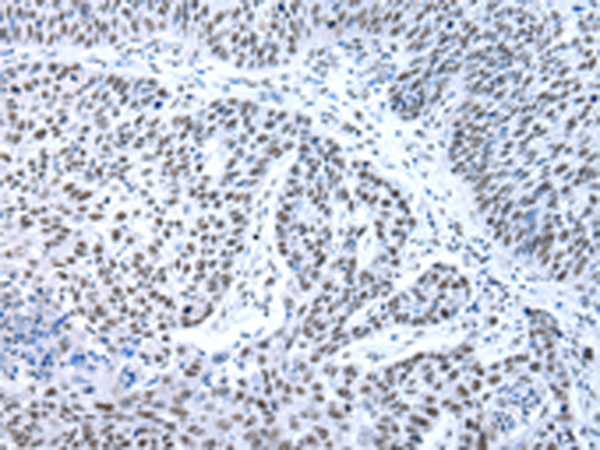 Rabbit Polyclonal Antibody to XAB2