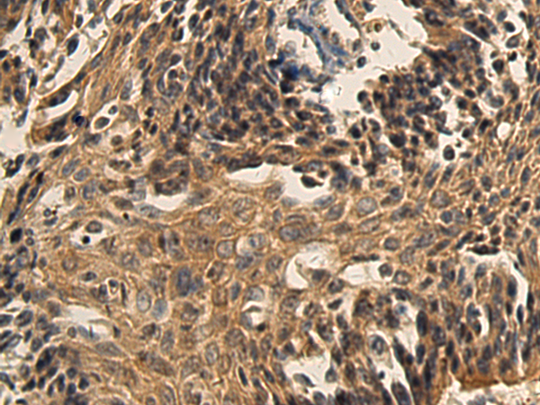 Rabbit Polyclonal Antibody to XAGE2