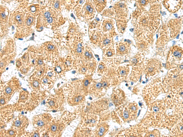 Rabbit Polyclonal Antibody to XKR6