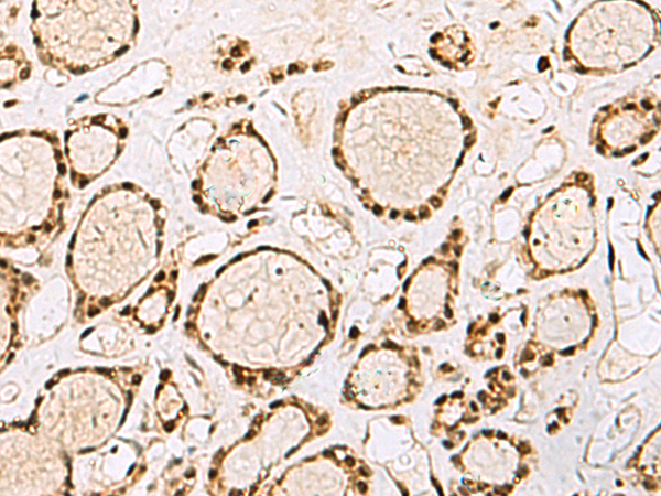 Rabbit Polyclonal Antibody to XRCC4