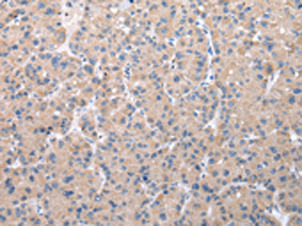 Rabbit Polyclonal Antibody to ZDHHC20