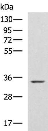 Rabbit Polyclonal Antibody to ZFAND1