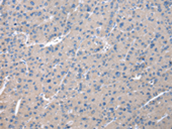 Rabbit Polyclonal Antibody to ZFAND5