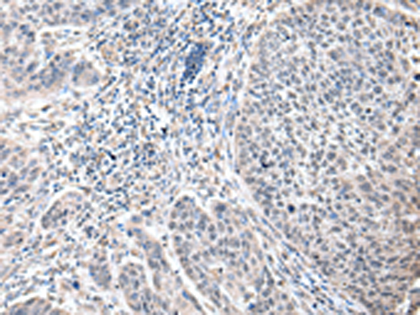Rabbit Polyclonal Antibody to ZFP64