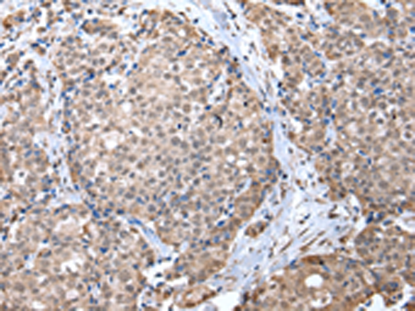Rabbit Polyclonal Antibody to ZFP91