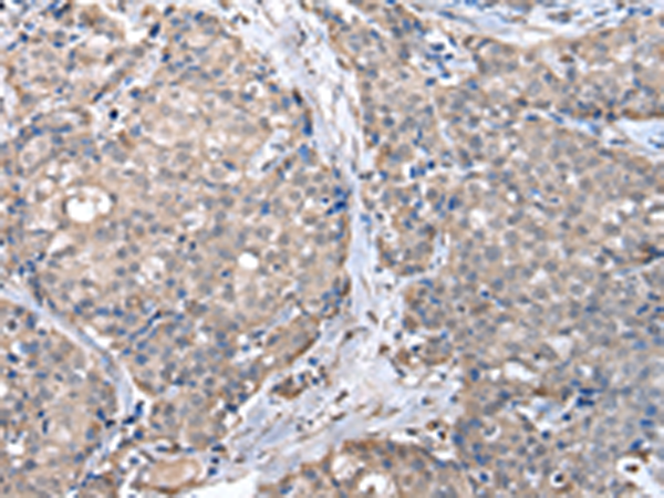 Rabbit Polyclonal Antibody to ZFP2