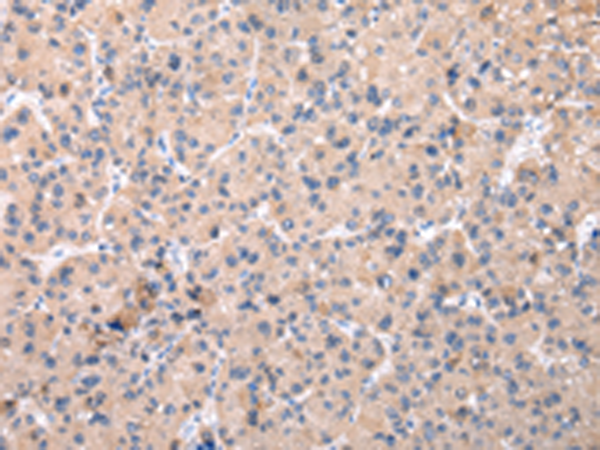Rabbit Polyclonal Antibody to ZNF268