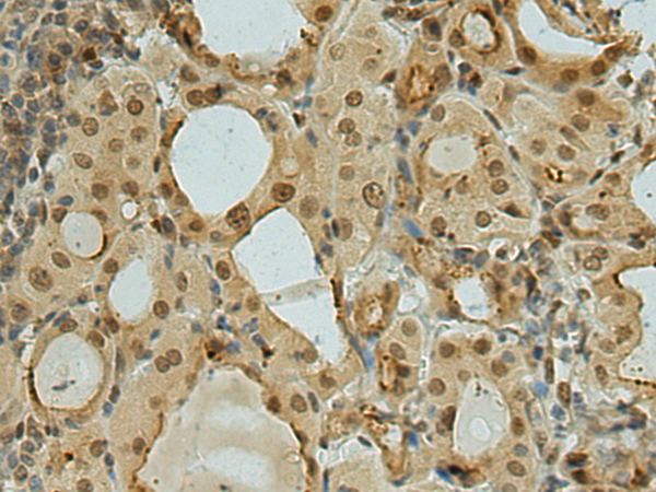 Rabbit Polyclonal Antibody to ZBTB20