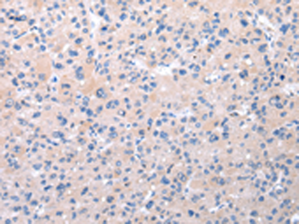 Rabbit Polyclonal Antibody to RNF115
