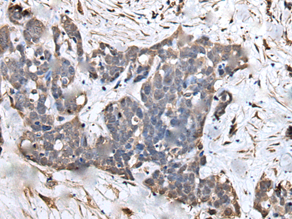 Rabbit Polyclonal Antibody to ZNHIT1