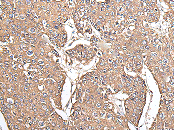 Rabbit Polyclonal Antibody to KRT73