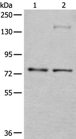 Rabbit Polyclonal Antibody to ATF6B