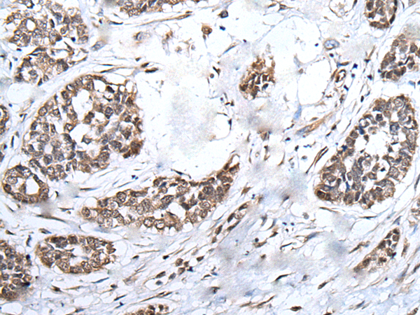 Rabbit Polyclonal Antibody to BRMS1L
