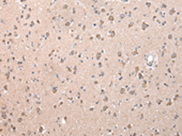 Rabbit Polyclonal Antibody to ZCCHC9