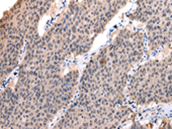 Rabbit Polyclonal Antibody to POLR2K