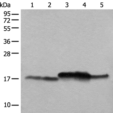 Rabbit Polyclonal Antibody to NDUFB11