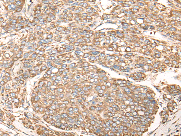 Rabbit Polyclonal Antibody to NDUFB6
