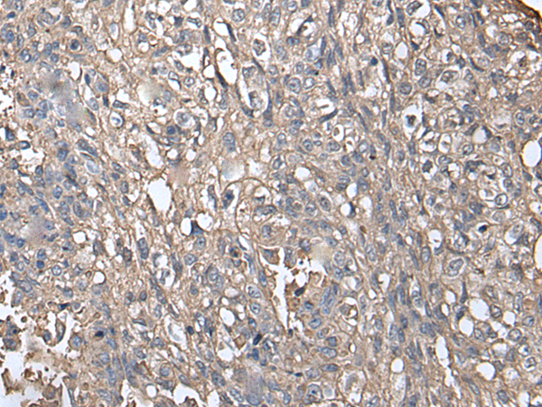 Rabbit Polyclonal Antibody to NDUFB5