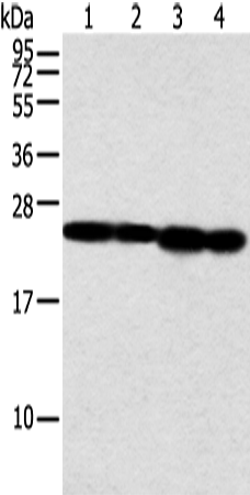 Rabbit Polyclonal Antibody to NDUFB9