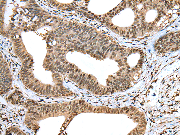 Rabbit Polyclonal Antibody to TIGD5