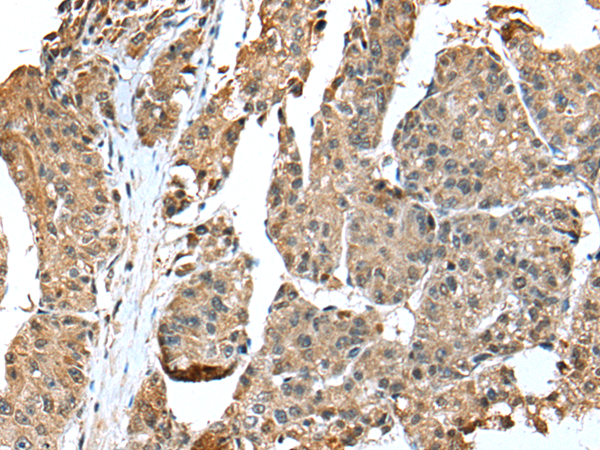 Rabbit Polyclonal Antibody to EML4