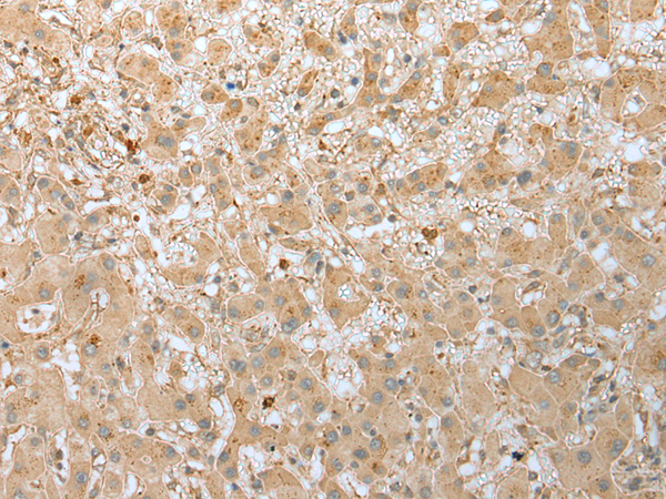 Rabbit Polyclonal Antibody to FNDC3B