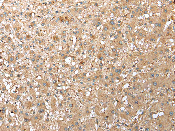 Rabbit Polyclonal Antibody to RPS21