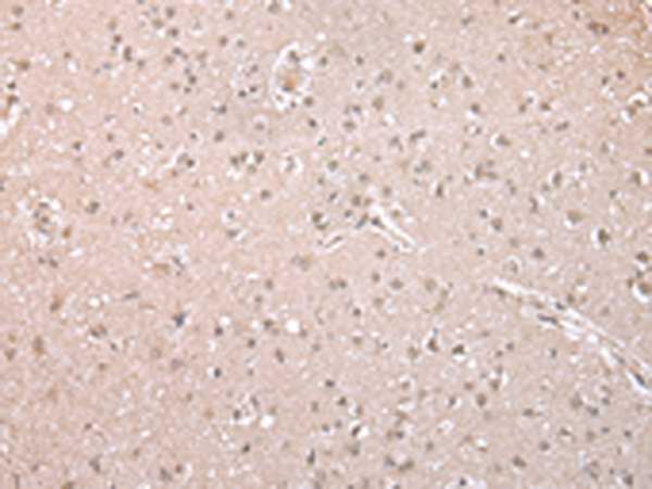 Rabbit Polyclonal Antibody to MLLT11