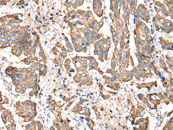 Rabbit Polyclonal Antibody to RABL2B
