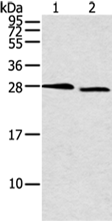Rabbit Polyclonal Antibody to DCXR