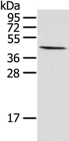 Rabbit Polyclonal Antibody to HIF1AN