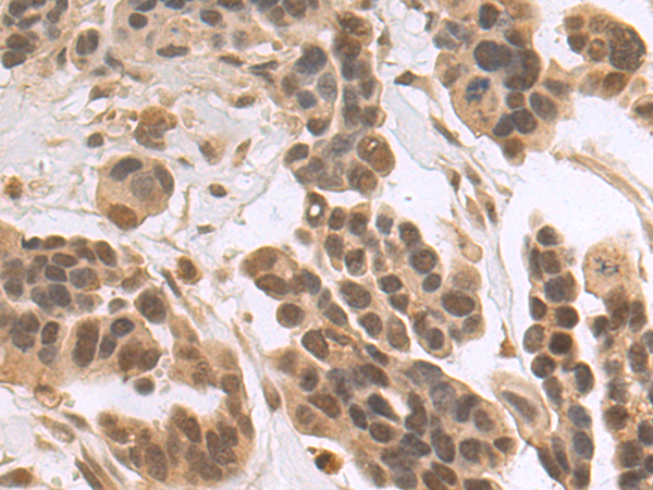 Rabbit Polyclonal Antibody to HIF1A