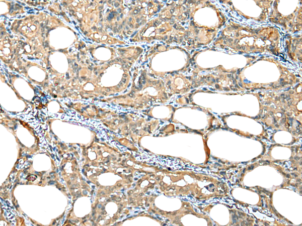 Rabbit Polyclonal Antibody to HIF1A