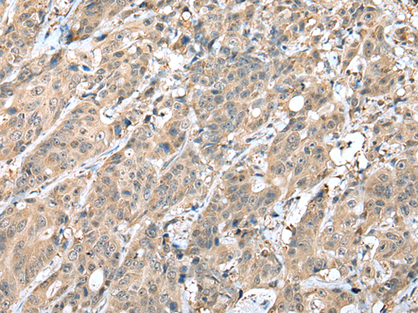 Rabbit Polyclonal Antibody to HIF1A