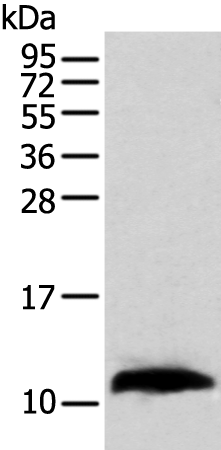 Rabbit Polyclonal Antibody to TBCA