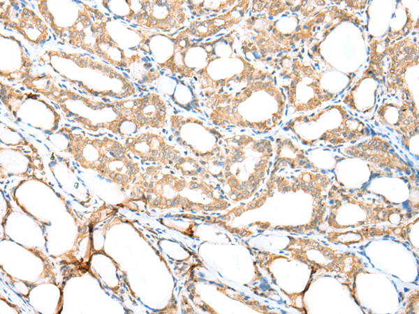Rabbit Polyclonal Antibody to CILK1