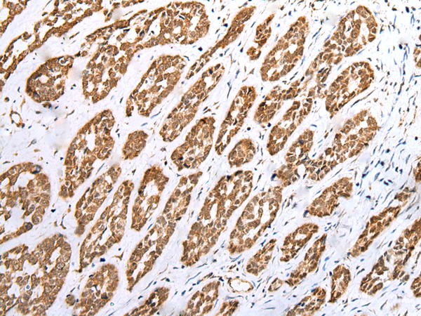 Rabbit Polyclonal Antibody to CRYZL1