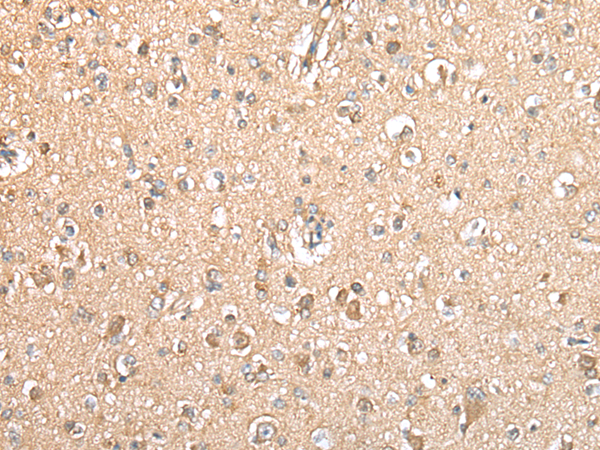 Rabbit Polyclonal Antibody to TYROBP